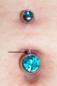 Scratched or nicked bar of jewelry could be causing irritation.