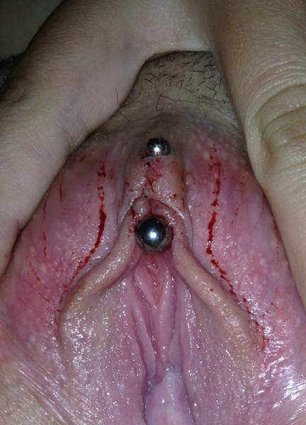 Accidental Clitoris Piercing (VCH requested)