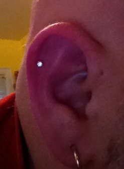 Piercing Gun Ear Cartilage Trouble