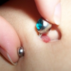 Navel piercing with Hypergranulation