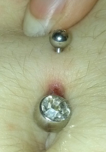 Navel Piercing Problem (With Photos 
