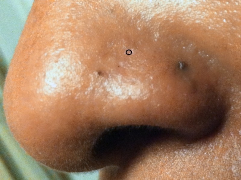 Nostril Placement Marked