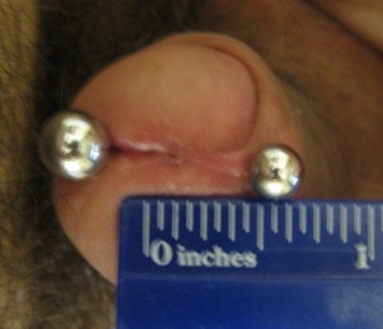 Prince Albert piercing on uncircumcised penis with ruler to indicate depth.
