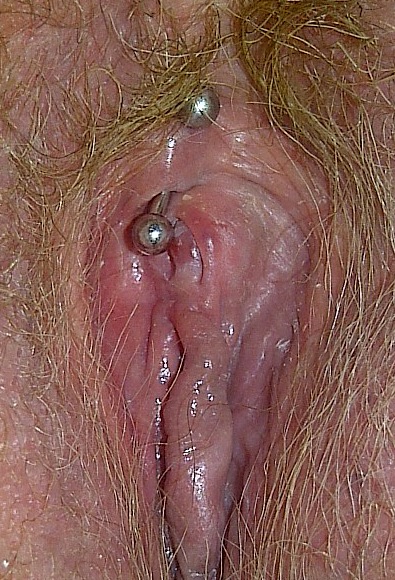 A Vertical Clitoral Hood (VCH) Surface Piercing Off to the Side