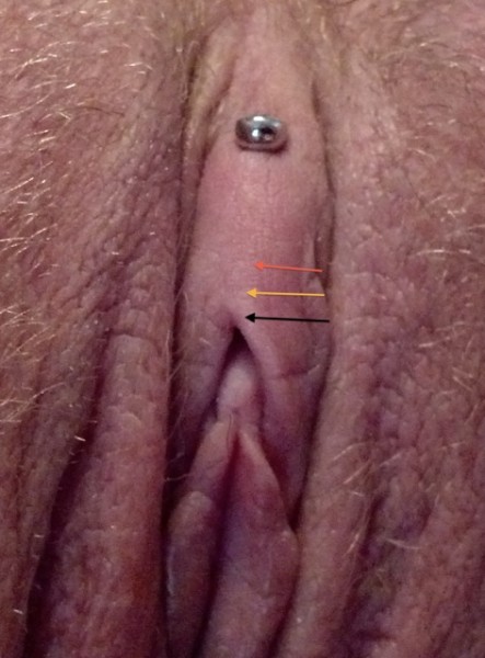 Vertical Clit Hood Piercing with arrows