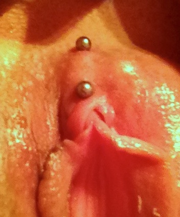 A Vertical Clitoral Hood (VCH) Surface Piercing 