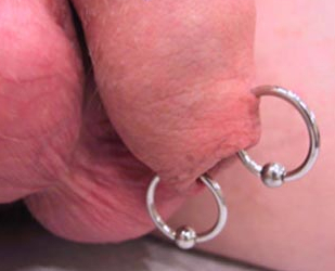 Foreskin piercings with rings at 12 and 6 o'clock