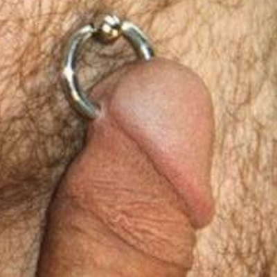 Prince Albert piercing with captive bead ring