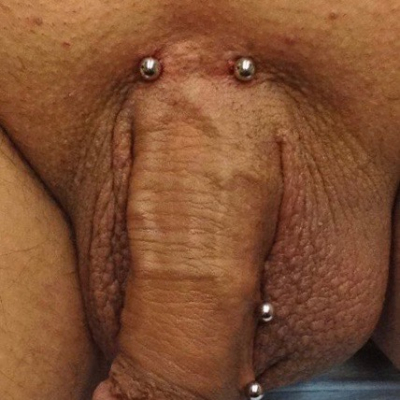 A pubic piercing with a curved bar on a man with frenum piercings