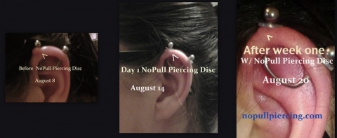 NoPull Piercing Disc®️ works. It is that simple. Wear as directed, app