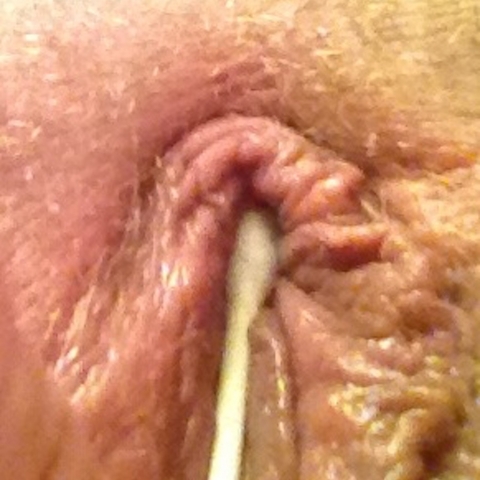 Unsuccessful test--the swab is caught up on the hood Thumbnail