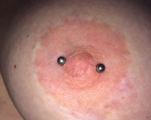 Nipple Piercing: Cost, Aftercare, Scarring, Pain, Cleaning