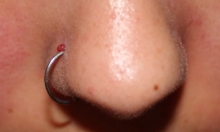 Granuloma nose piercing on sale treatment